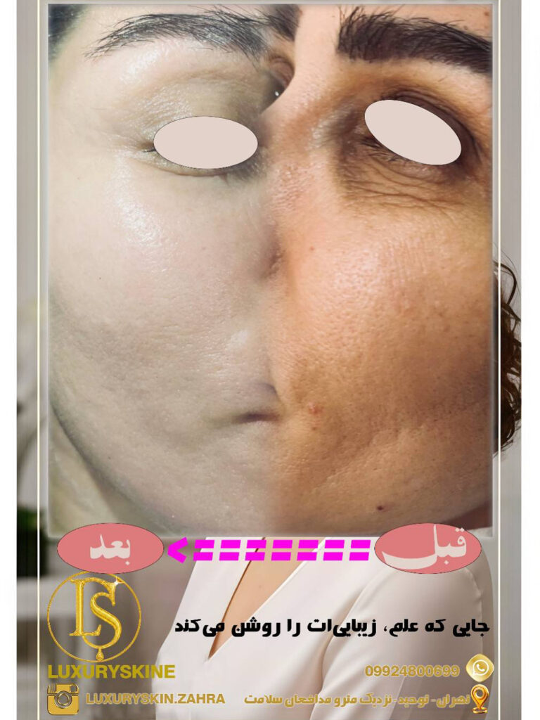 زیبایی پوستت را با Luxuryskin آشکار کن! ✨