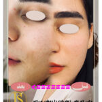 زیبایی پوستت را با Luxuryskin آشکار کن! ✨