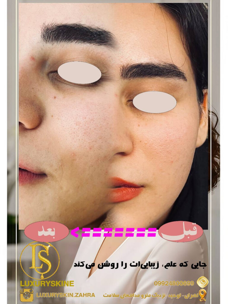 زیبایی پوستت را با Luxuryskin آشکار کن! ✨
