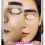 زیبایی پوستت را با Luxuryskin آشکار کن!