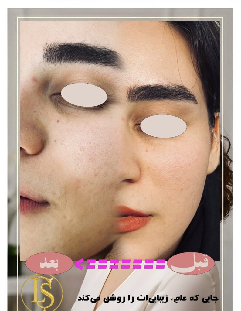 زیبایی پوستت را با Luxuryskin آشکار کن!